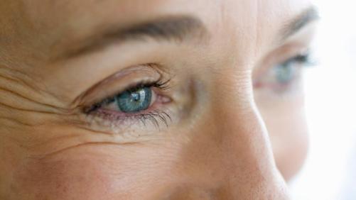 prevent-reduce-eye-wrinkles_d98211c23c1b455f